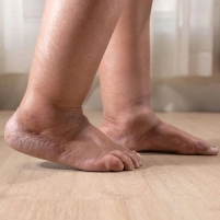 Swelling in Legs or Feet