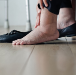 Swelling in Legs, Ankles, or Abdomen