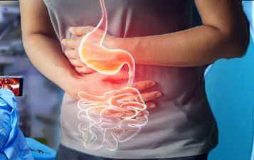 Gastrointestinal Surgeries