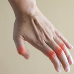 Injuries Leading to Joint Deformities