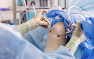 Arthroscopy