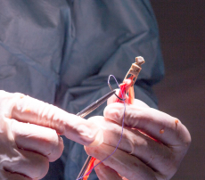 Minimally Invasive Options