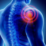 Persistent Back Pain