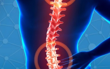 Spinal Deformity Treatment