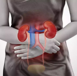 Recurring Urinary Tract Infections (UTIs)